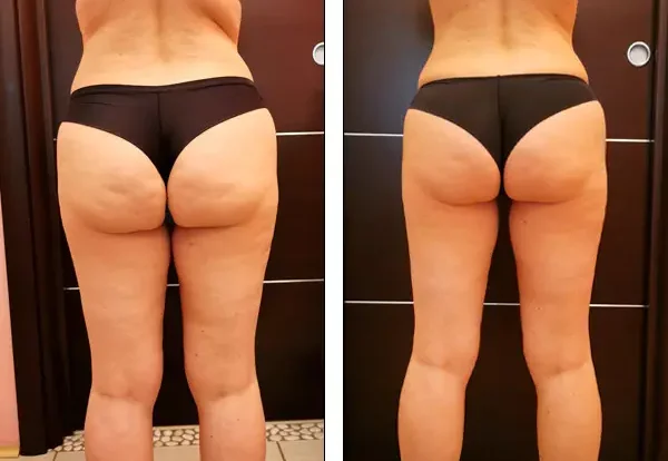 Mudra Body Change
